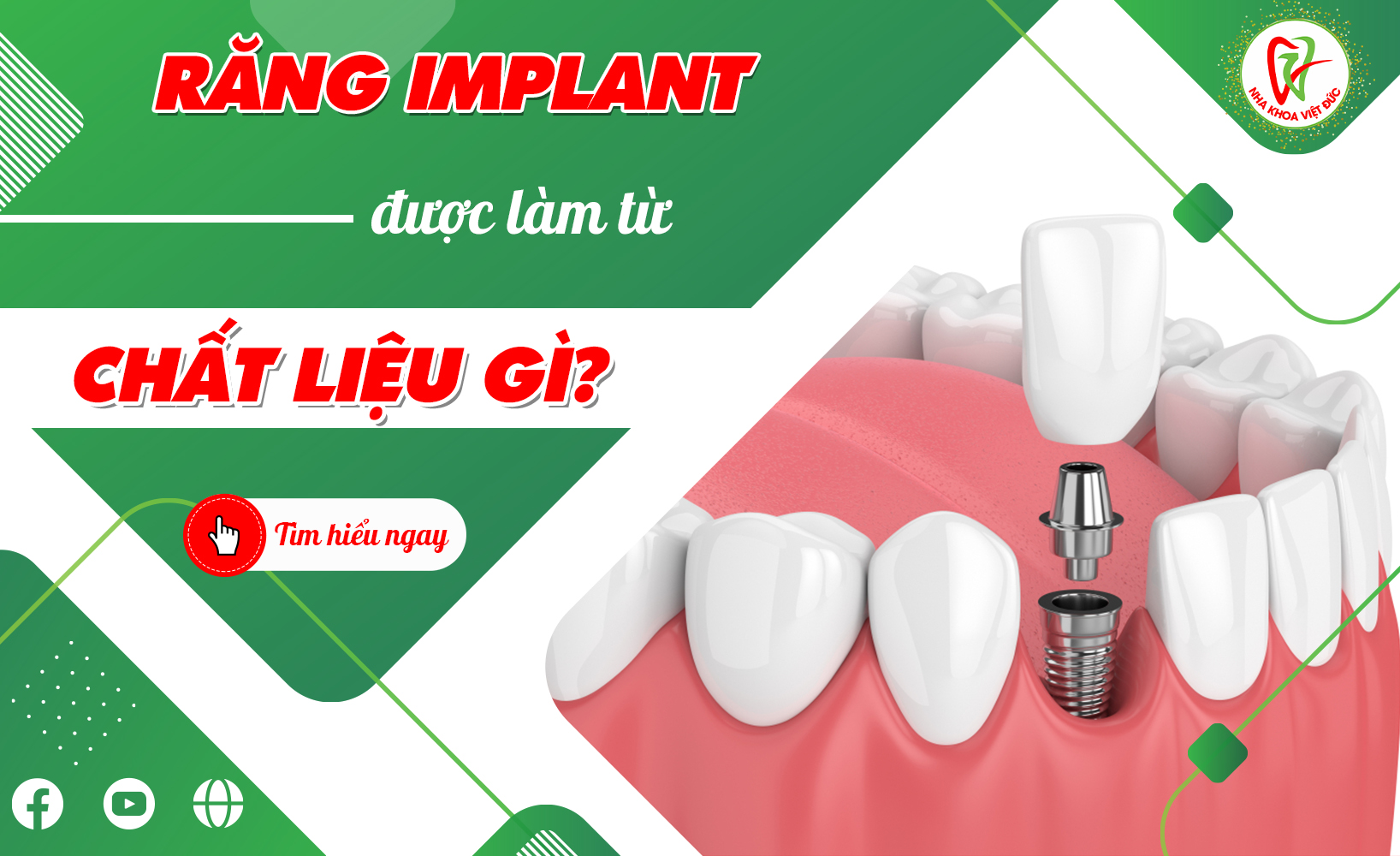 RĂNG IMPLANT ĐƯỢC LÀM TỪ CHẤT LIỆU GÌ?