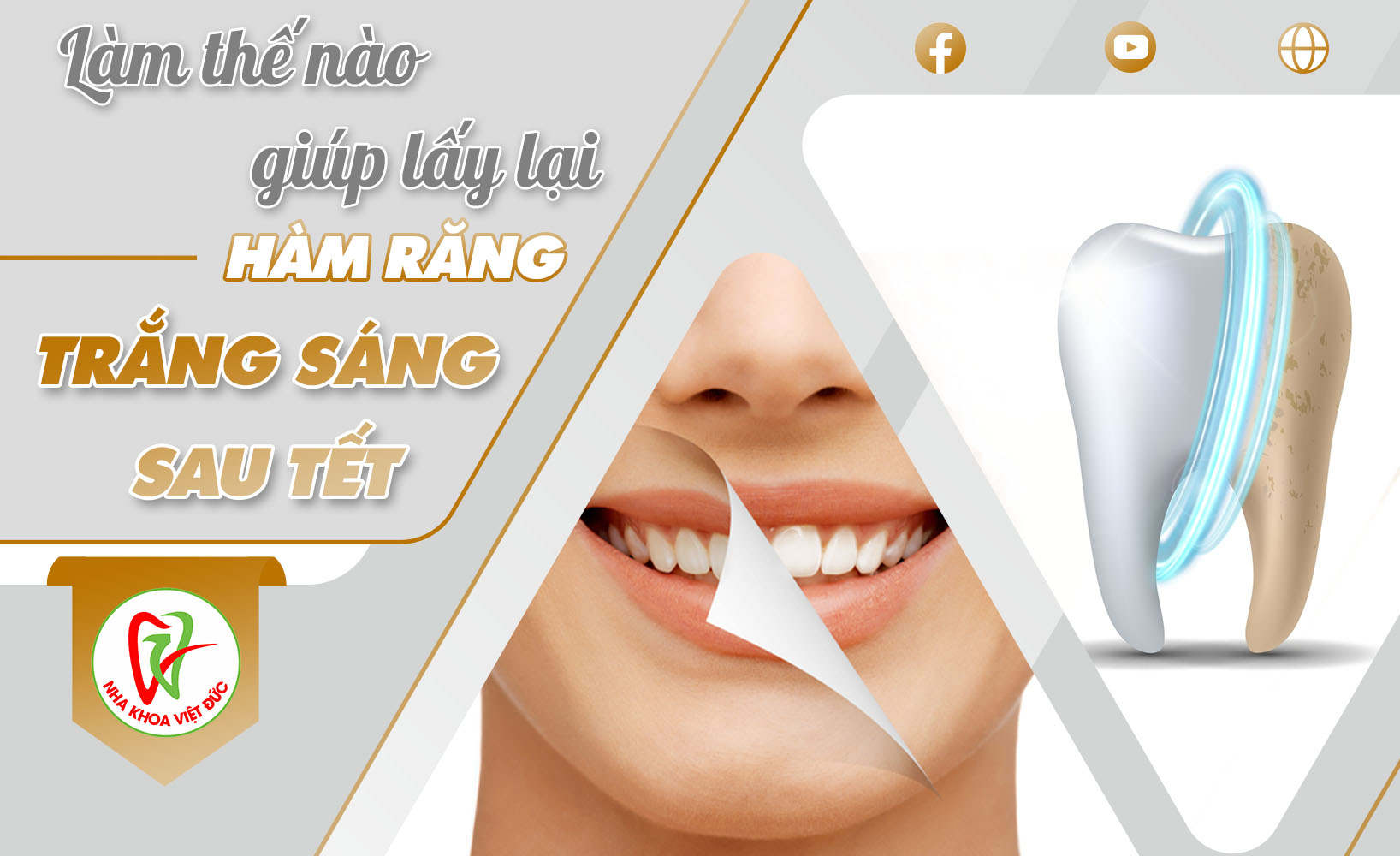 LÀM THẾ NÀO GIÚP LẤY LẠI HÀM RĂNG TRẮNG SÁNG SAU TẾT?