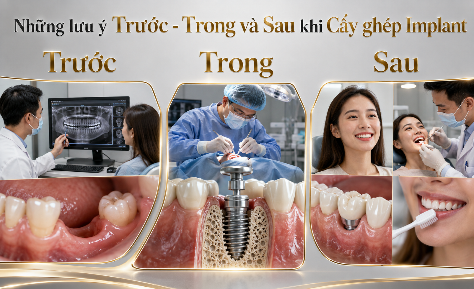 Trồng Implant có đau không? Dấu hiệu cần lưu ý